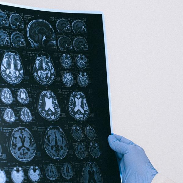 brain imaging